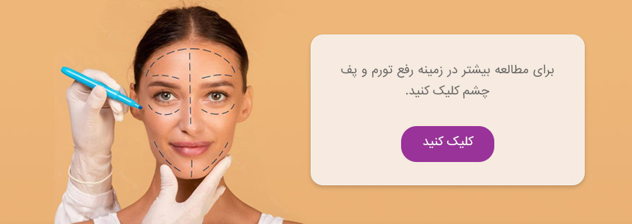 رفع تورم و پف چشم
