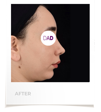 افضل جراح تجميل الوجه في إيران