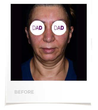 افضل جراح تجميل الوجه في إيران