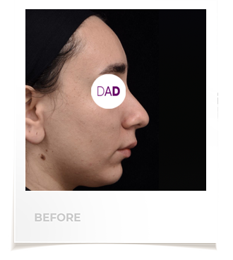 افضل جراح تجميل الوجه في إيران